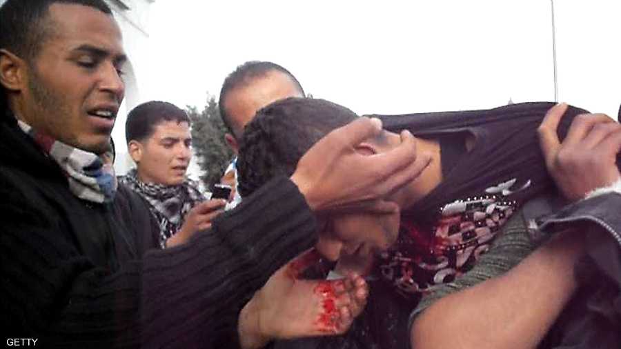 جريح تونسي أصيب برصاصة خلال اشتباكات مع قوات الأمن في الرقاب قرب سيدي بوزيد يوم 09 يناير2011