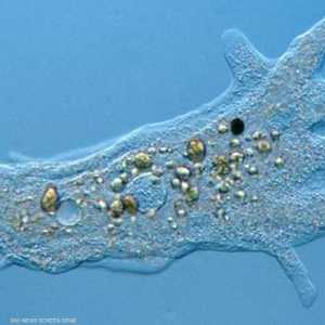 صورة مجهرية للأميبا القاتلة