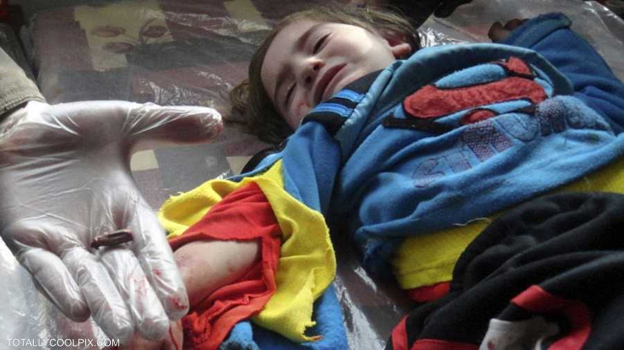 نجت هذه الطفلة من الموت بعد إخراج رصاصة تلقتها خلال احتجاجات سوريا