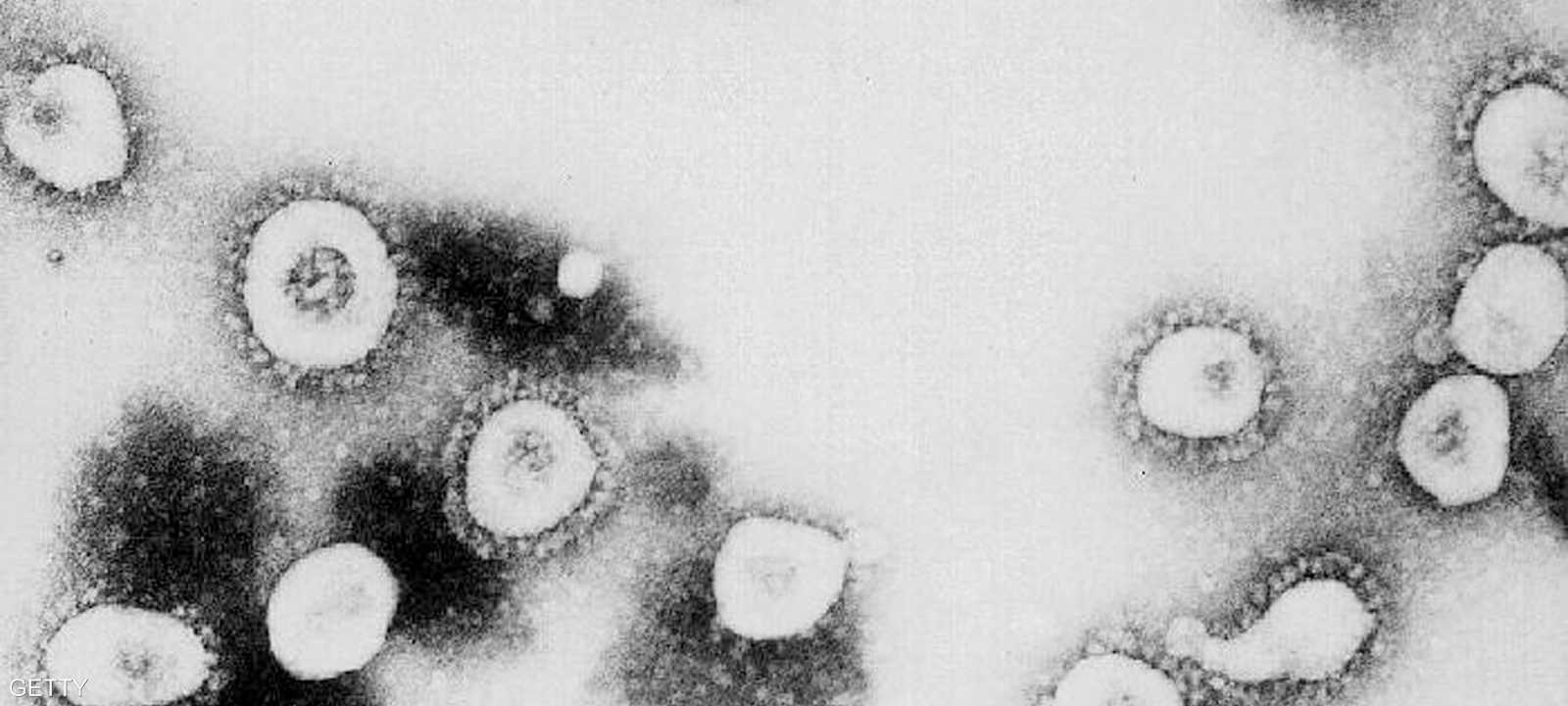 تقول الدراسة إن "كورنا" يختلف عن "سارس" بجوانب هامة
