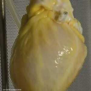 القلب نبض بمعدل 40 إلى 50 نبضة بالدقيقة