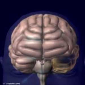 مرض باركنسون أكثر شيوعا عند كبار السن