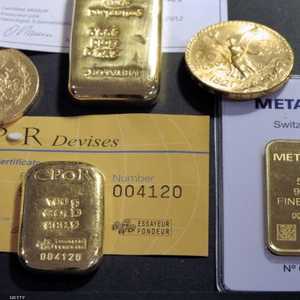 عثر الأطباء على 12 سبيكة ذهبية في معدة الرجل