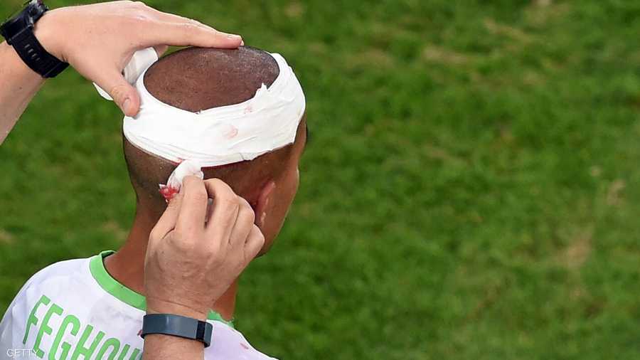 اللاعب الجزائري سفيان فيغولي أصيب بالرأس من تدخل من زميله في المنتخب