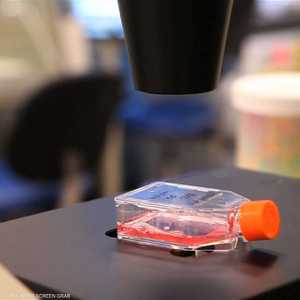 أكثر من ستة ملايين شخص أو 18% من السكان في جنوب إفريقيا مصابون حاليا بالمرض