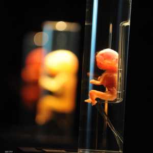 تصنف منظمة الصحة العالمية هذه الحالة كونها إحدى أنواع مرض السرطان