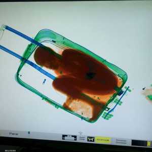 صورة الطفل داخل الحقيبة كما كشفت عنه أشعة إكس