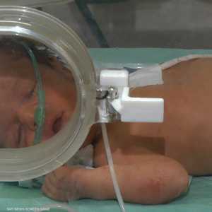 البكتيريات تتسبب بنصف مليون ولادة مبكرة سنويا