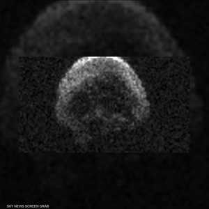 الكويكب الذي يقترب من الأرض يحمل شكل جمجمة بحسب صورة التقطها المرصد "آرسيبو"