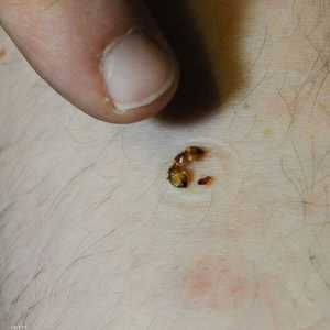 بق الفراش يتغذى على الدماء