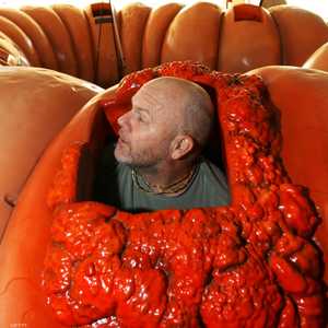 شخص يخرج من مجسم قولون أصابه السرطان.