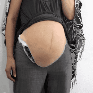 كميات من الكوكايين في بطن صناعية كاذبة توحي بالحمل