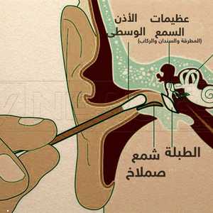 إدخال عود القطن داخل الأذن