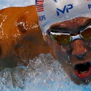 البقع الداكنة على كتفي فيليبس تعود إلى استخدام  الحجامة