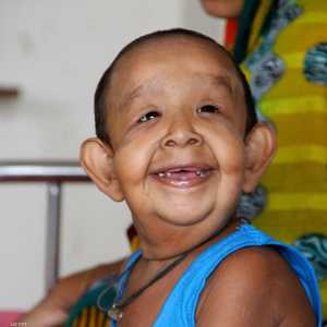 الطفل بايزيد عمره 4 أعوام فقط وحالته محل جدل بين الأطباء