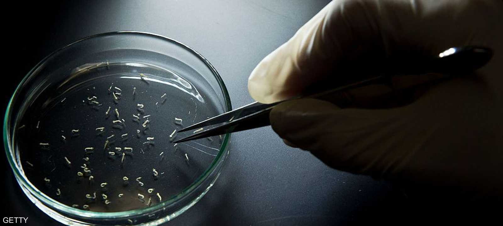 يصاب الإنسان   بمتلازمة غيلان- باريه بعد  تعرضه لعدوى بكتيرية