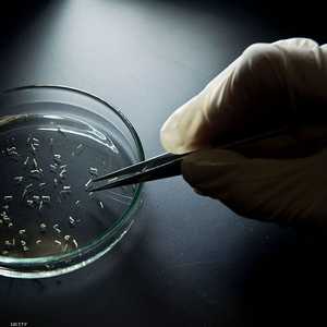 يصاب الإنسان   بمتلازمة غيلان- باريه بعد  تعرضه لعدوى بكتيرية