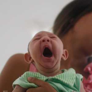 التشوهات تحدث بعد الولادة بحسب الدراسة