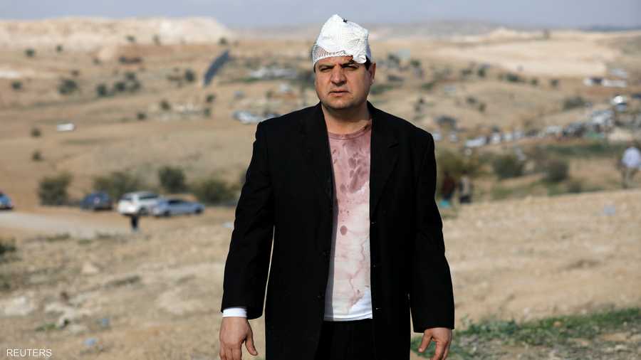 النائب العربي في الكنيست أيمن عودة بعد إصابته في مواجهات القرية