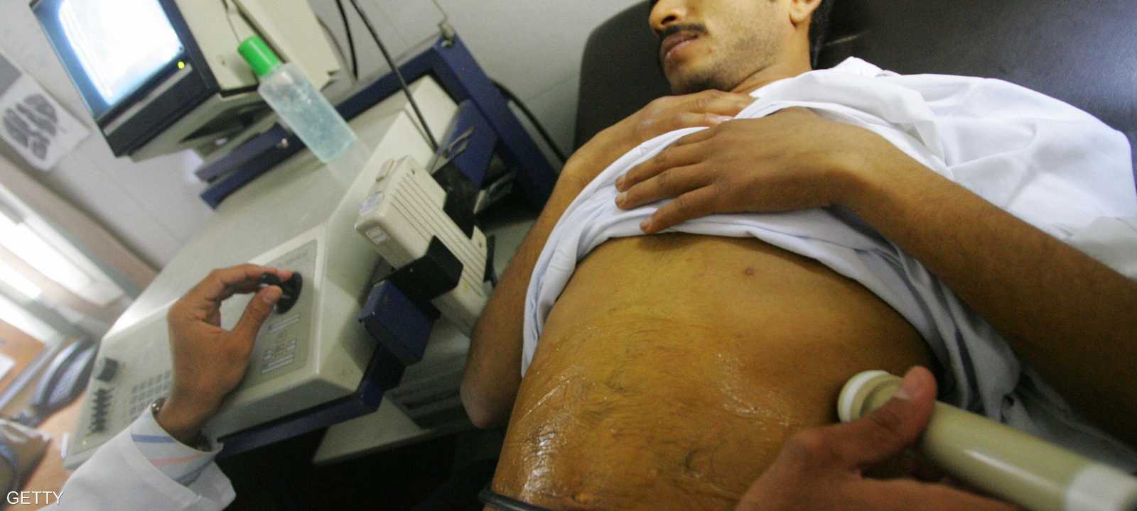 أحد مرضى الكبد يخضع لفحص طبي في مستشفى بالقاهرة