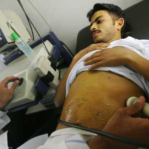 أحد مرضى الكبد يخضع لفحص طبي في مستشفى بالقاهرة