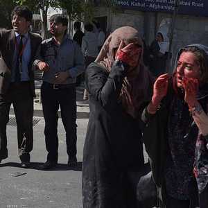 مصابون في التفجير الدامي الذي ضرب كابل وأوقع 150 قتيلا