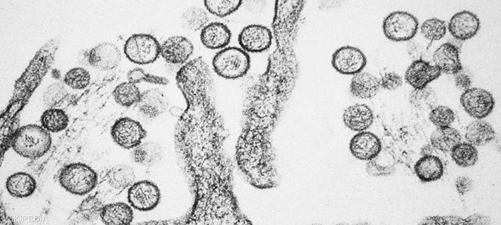 فيروس هانتا الرئوي