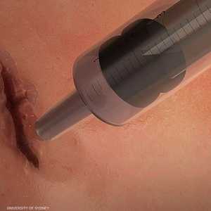 صورة لكيفية عمل المادة الغروية