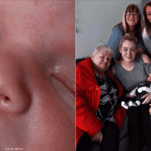 الطفل ولد وفي فمه سن كامل النمو