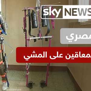 ابتكار مصري يساعد المعاقين على المشي