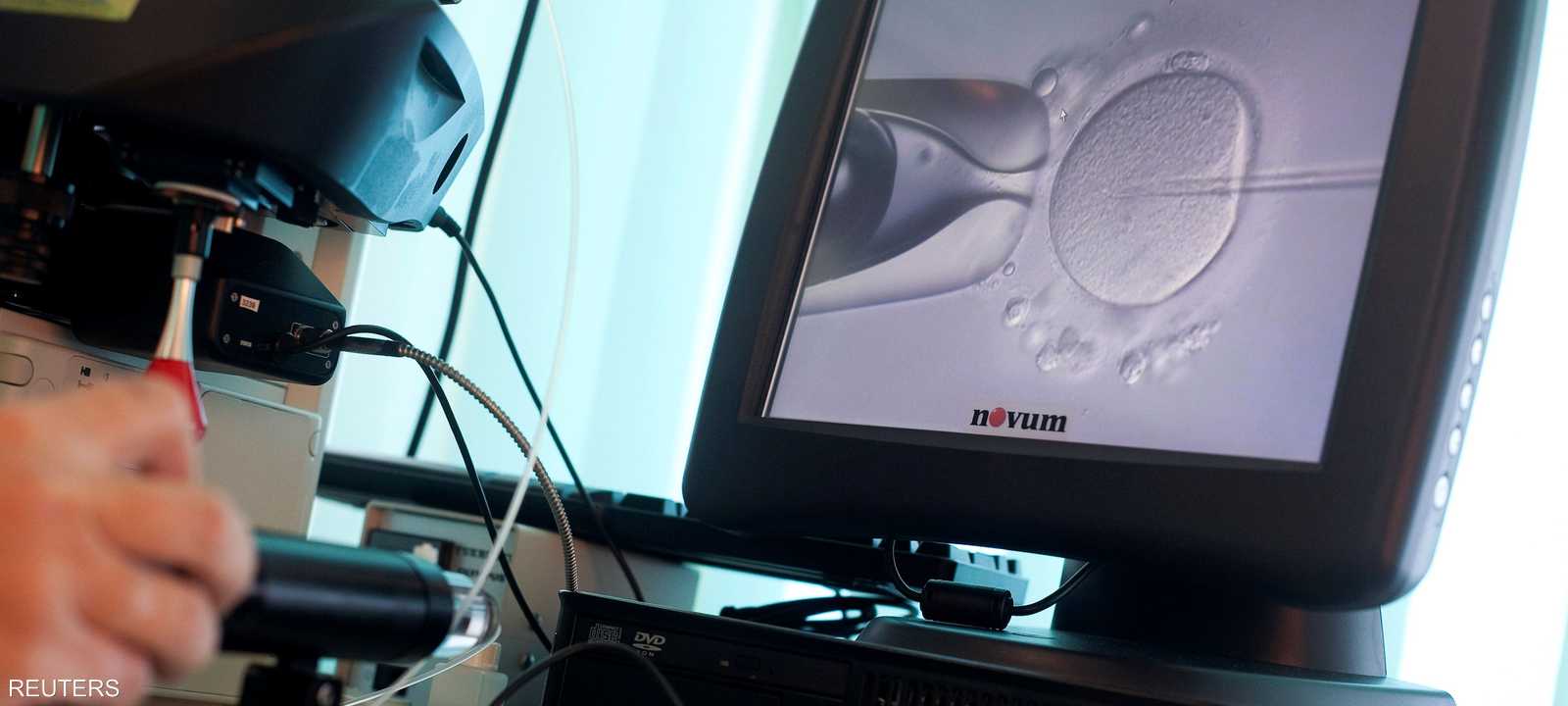 حقن حيوان منوي في بويضة مباشرة