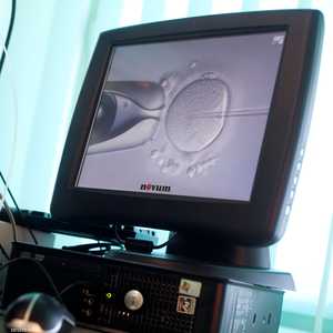 حقن حيوان منوي في بويضة مباشرة