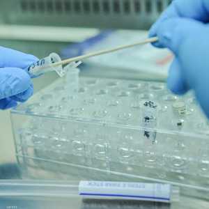 يطور العلماء خلايا مقاومة للفيروسات والشيخوخة والسرطان