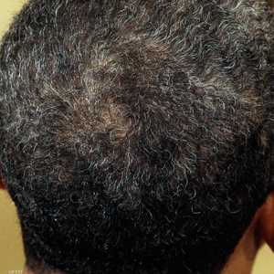 شعر أشيب (صورة تعبيرية)