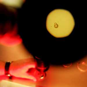 تلقيح صناعي