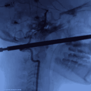 صورة أشعة للحادثة