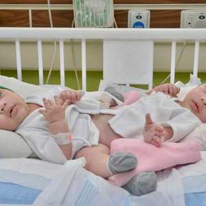 التوأم السيامي السعودي شيخة وشموخ