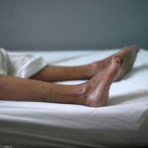 تتفاقم الإصابة بالمتلازمة مع التقدم مع العمر