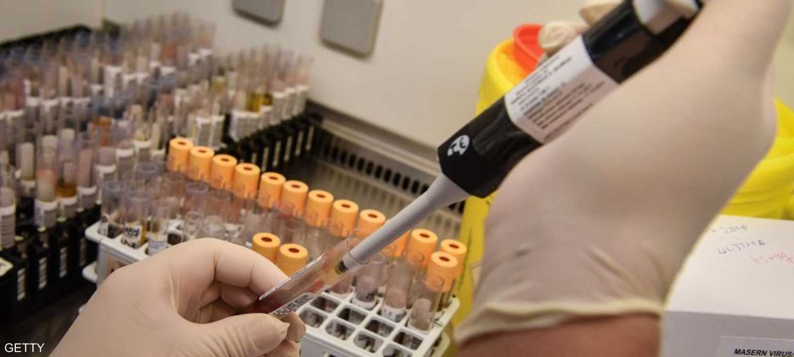 يقوم المشروع على تعديل وراثي بالفيروسات التي تهاجم المحاصيل