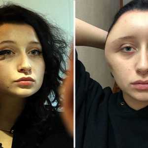 تورم رأس إستلا بعد وضع قليل من الصبغة على شعرها