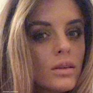 ريتشيل كانبيير تعرضت لتجربة بوتوكس سيئة