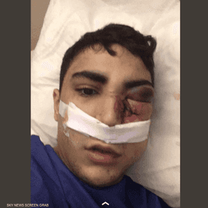 مهدي تعرض لضرب مبرح من الشرطة الفرنسية