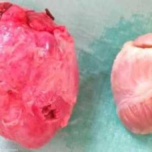 جراحة نقل القلب من الخنزير إلى القرد سجلت نجاحا