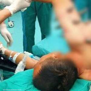 خلل في روبوت أدى إلى هذا الحادث