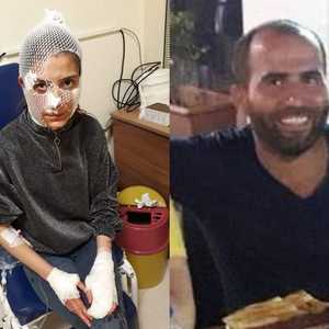 المرأة أصيبت بجراح في وجهها ويديها.