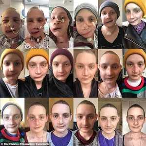 جين تايلور كانت مصابة بورم في الفك العلوي