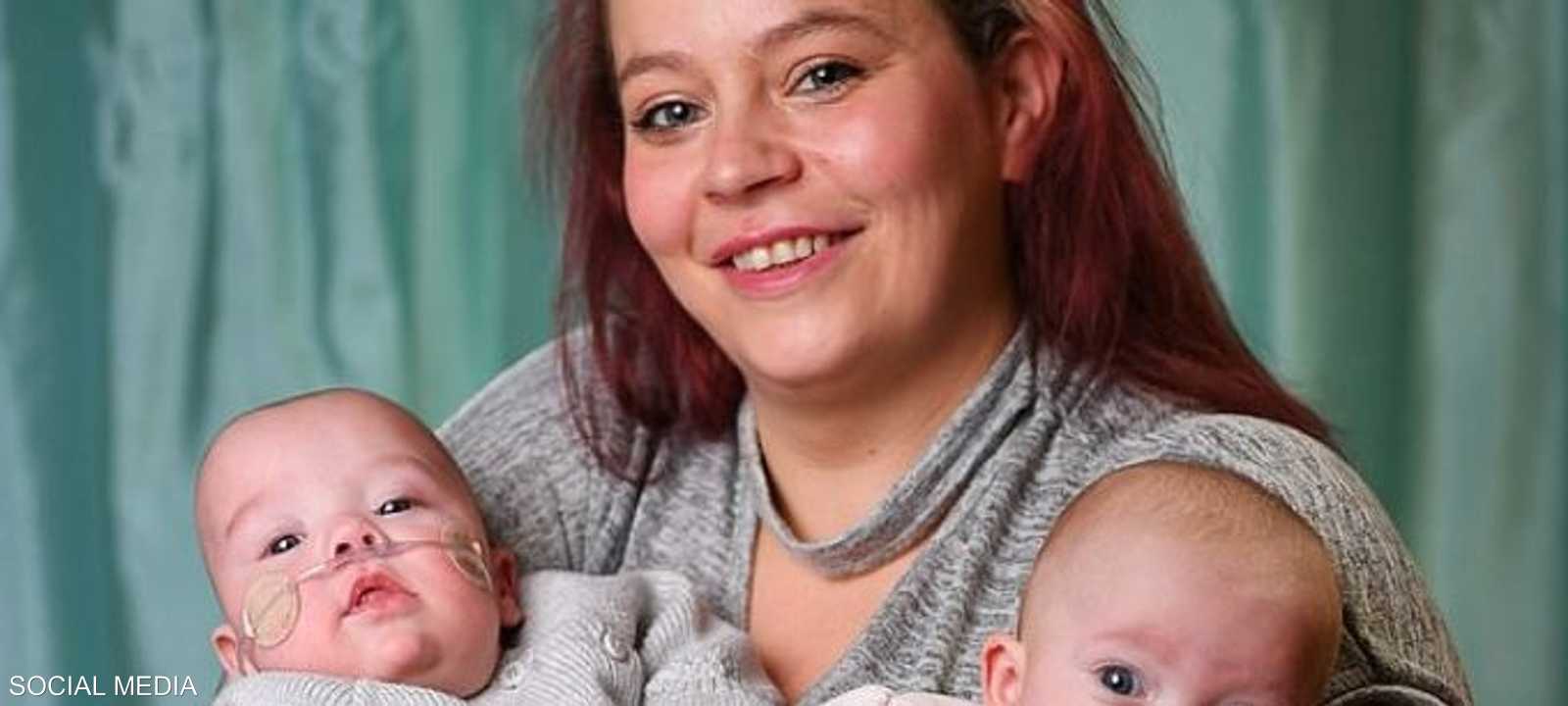 أيام فصلت ولادة الطفلين