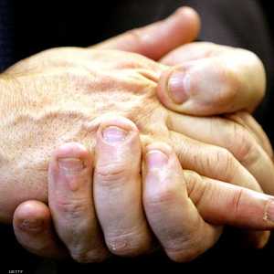 ضعف الأظافر مؤشر على نقص فيتامين B7.