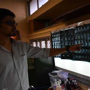 غسل الأسنان يخفض خطر الإصابة بمرض الزهايمر