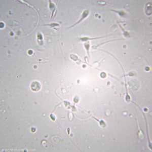 الطريقة مستوحاة من طريقة الكوكتيل ذو الطبقات